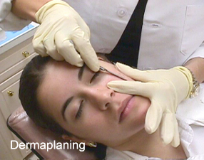 Derma planing