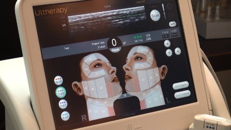 xUltrasound,P20Imaging,P20-,P20Ultherapy,P20Device,P20-,P20Web.jpg.pagespeed.ic.M7EZpWBtBl